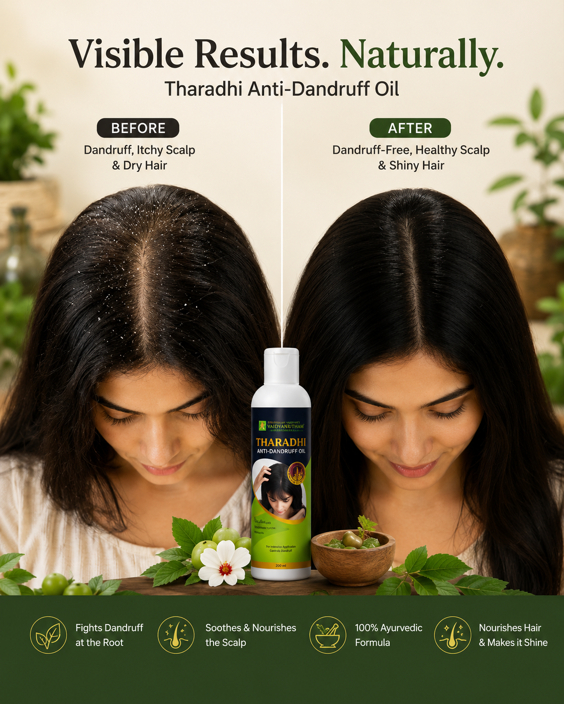 Tharadhi Anti-dandruff Oil